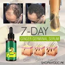 Ginger Hair Essence Anti Hair Loss Prevention Hair Loss Hair Care Essential Oil Scalp Care Beauty Health Care Men and Women